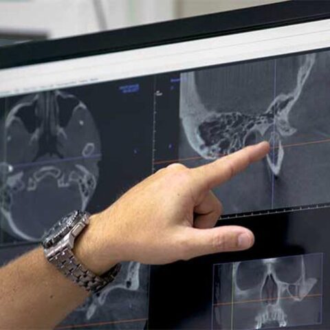 CBCT (cone-beam computed tomography)